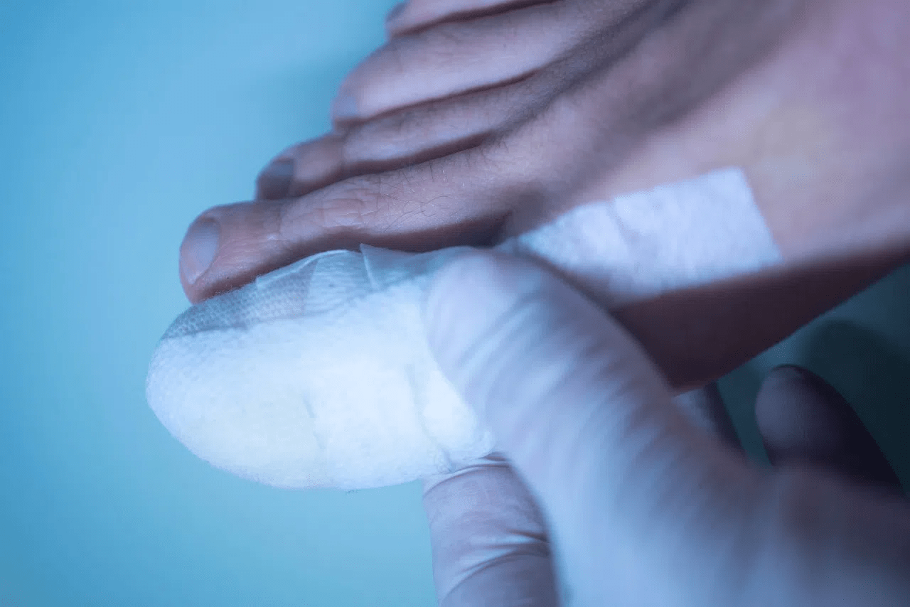 Did you have surgery to insert a Cartiva implant into your big toe joint? If the implant failed, you may be entitled to compensation.